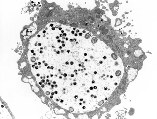 Chlamydia trachomatisの電子顕微鏡像